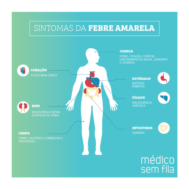 sintomas da febre amarela Médico Sem Fila